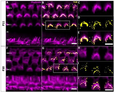 Distribution of ciliary adaptor proteins tubby and TULP3 in the organ of Corti